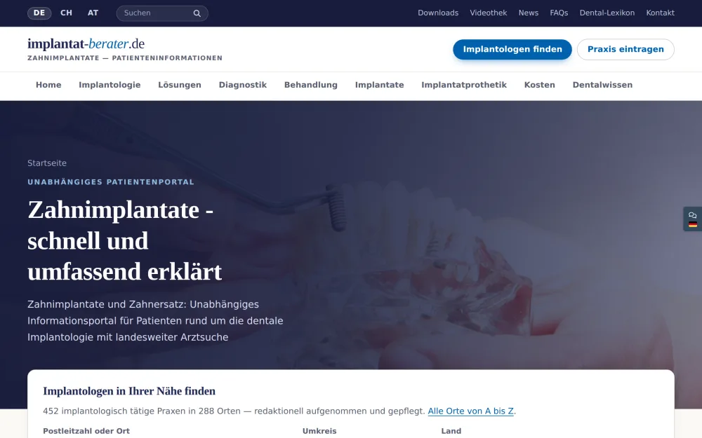 Startseite von implantat-berater.de